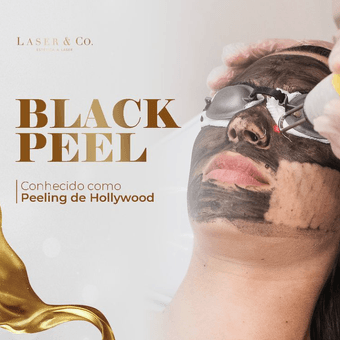 Hollywood Peel (Black Peel) -  10 Sessões - Laser & Co.