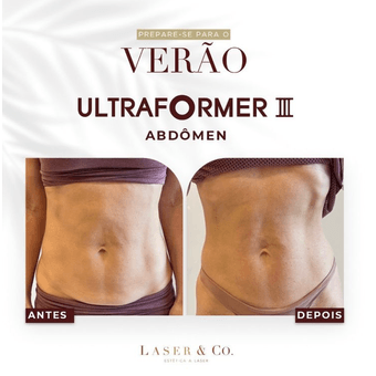 Ultraformer - Abdômen - 3 Sessões - Laser & Co.